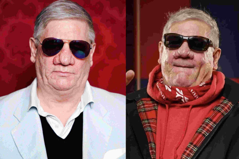 Claude-Oliver Rudolph Nase Krankheit: Was steckt wirklich dahinter? claude-oliver rudolph nase krankheit